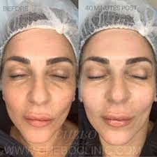 We did not find results for: 5d Hifu Information Chebo Clinic