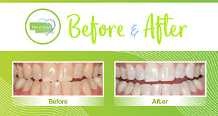 Explore other popular health & medical near you from over 7 million businesses with … Cosmetic Dentistry Top Cosmetic Dentists In Lincoln Ne