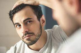 Daher ist es sinnvoll, wenn der haarausfall stagniert. Haartransplantation Fur Wen Sinnvoll Geeignet Tophairclinic
