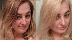 Developer (hydrogen peroxide) is naturally acidic. How To Lighten Hair With Hydrogen Peroxide Bellatory