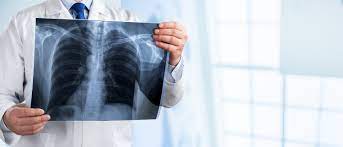 Unimed, cenibra, vale e cemig. A Importancia Dos Exames De Imagem Para O Diagnostico E Tratamento Das Doencas Sao Camilo