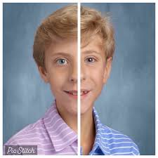 Identical twins 5 minutes apart