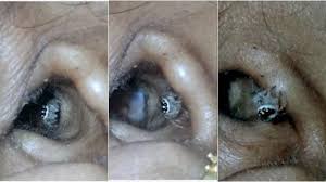 Perkara ini akan menganggu tumbesaran dan perkembangan fizikal terutamanya dalam. 7 Hewan Ini Pernah Ditemukan Hidup Di Tubuh Manusia Ada Cacing Pita Yang Bersarang Di Otak Tribun Travel