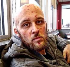 My name is Hunter and I have 2466 days of sobriety