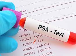 Image result for psa test results