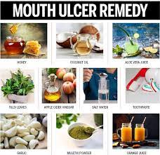 Oral ulcers usually heal on their own without resorting to treatment. Mouth Ulcer Remedy At Home Femina In