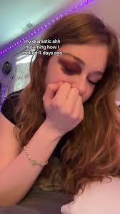 Black Eye Before and After