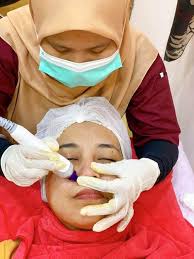 Places bangi, malaysia medical & healthdoctordermatologist klinik pakar kulit dan alahan annur bangi. Pengalaman Buat Rawatan Microdermabrasion Dan Hifu Di Klinik Dr Bazilah Bangi