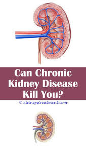 Kidney Disease Symptoms Watches Polycystic Kidney Disease Kidney Infection Causes Kidney Disease Diet