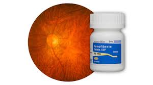 Image result for Fenofibrate