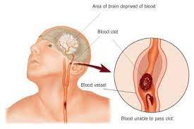 How the coronavirus can and cannot spread. Rumah Farah Which Four Body Systems Interact To Allow A Person To Sneeze The Reproductive System Systems In The Human Body Siyavula