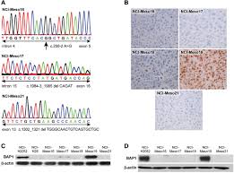 Maybe you would like to learn more about one of these? Mesothelioma Patient Derived Tumor Xenografts With Defined Bap1 Mutations That Mimic The Molecular Characteristics Of Human Malignant Mesothelioma Bmc Cancer Full Text