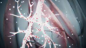 Covid 19 Symptoms What We Know Now And What To Do