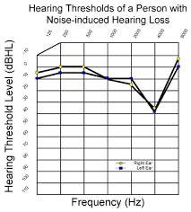 Noise Induced Hearing Loss