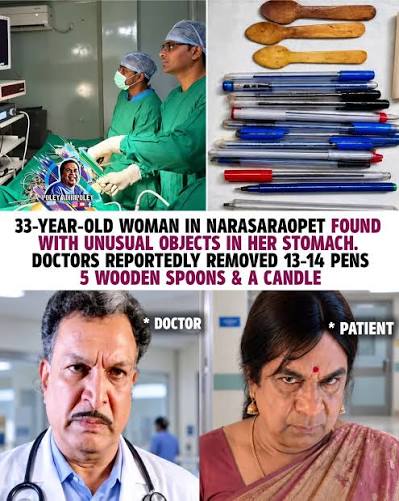 Ala yela tinnav akka🥲😒🤯 Doctors in Narasaraopet performed a laparoscopic surgery on a 33-year-old woman after scans revealed she had 14 pens, 5 wooden spoons and a candle in her stomach. She