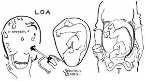 Left Occiput Anterior Loa Spinning Babies Baby Position Spinning Babies Baby Mapping