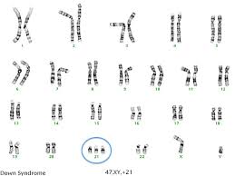Prenatal Testing Overview Genetic Counseling