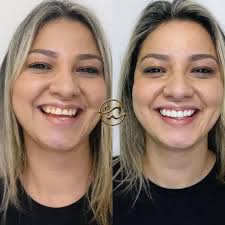 Sorrisos e Sonrisitas. (@sorrisosesonrisitas) · Instagram 照片和视频