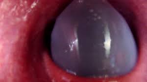 Internal Anal Camera Bad Dragon Flint Fucks My Ass And Cums In A Condoms  And Fills My Guts, Heartbea