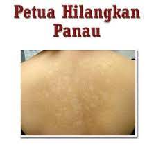 Panau is a diverse country in terms of religion, having been influenced by spain, indonesia, and india over the years. Ada Panau Ke Kat Muka Bahaya Delisa Beauty By Azira Facebook