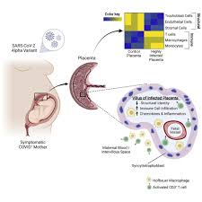 Inflammatory responses in the placenta upon SARS-CoV-2 infection late in  pregnancy: iScience