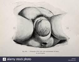 Image result for human birth