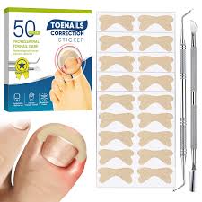 100pcs Ingrown Toenail Treatment Strips and Corrector Patch Set