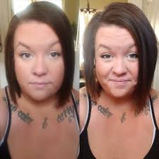 Embracing hair loss with confidence