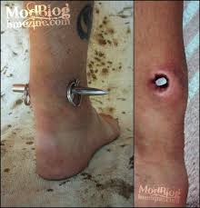 Places to buy jewelry and aftercare solutions Painful Piercings Mr Tetanus Extreme Achilles Heel Body Modification