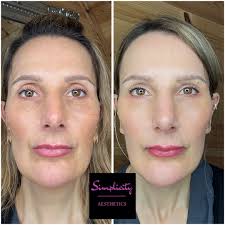 Simplicity Aesthetics and Skin Care