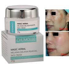 We cover hyperpigmentation creams, treatments and remedies, everything you need to remove unwanted skin pigmentation. Chumolee Strong Whitening Cream Freckle Cream Remove Melasma Acne Dark Pigment Spots Melanin Pimple Cream Face Cream Skin Care Facial Self Tanners Bronzers Aliexpress