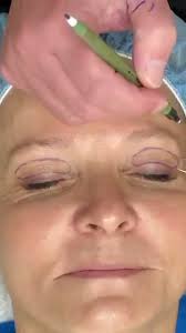 Crow's Feet: Marking & Procedure Guide