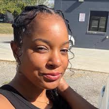 What are the treatments for scalp irritation after a retie?