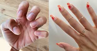 If your broken acrylic nail is still partially on your finger, remove it by soaking. What Are Gel Nail Extensions Everything You Need To Know About The Healthier Version Of Acrylics