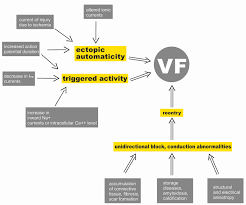 Image result for Ventricular Fibrillation Management in the Adult