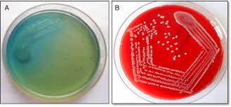 Short protocol for staphylococcus aureus pfge. Surveillance Of Bacteria Pseudomonas Aeruginosa And Mrsa Associated With Chronic Suppurative Otitis Media