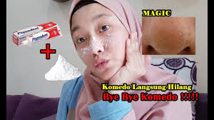 Tips Menghilangkan Komedo Di Hidung Pakai Odol Dan Garam Youtube