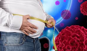 Stomach cancer is the growth of cancer cells in the lining and wall of the stomach. Stomach Cancer Symptoms And Signs Are More Likely To Occur If You Have These Risk Factors Express Co Uk