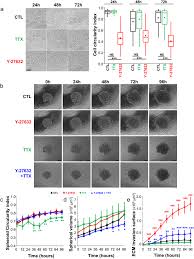 Restez informés avec le journal de saône et loire : Rock Inhibition Promotes Na V 1 5 Sodium Channel Dependent Sw620 Colon Cancer Cell Invasiveness Scientific Reports