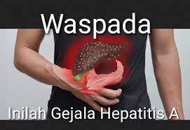 Learn more about the symptoms, causes, diagnosis, treatment, and vaccine for hepatitis a. Waspada Inilah 5 Gejala Hepatitis A Warbiasak