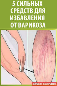 как очистить организм от шлаков и токсинов народными средствами 5 Silnyh Sredstv Dlya Izbavleniya Ot Varikoza Health Natural Health Home Remedies