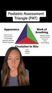 Image result for Pediatric Assessment Triangle