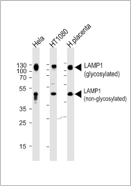 Igg is a widely expressed serum antibody. Znxuq4qmr7huqm