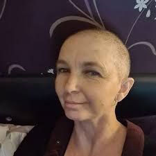 Mum, 50, given devastating diagnosis after falling from ladder at her  workplace