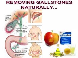 Read about tests for gallstones from cleveland clinic. What You Eat Has An Impact On Every Part Of Your Body By Dr Nikunj Gupta Lybrate