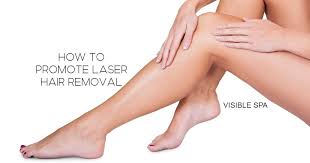 Cynosure's laser hair removal treatments target and destroy the hair cells responsible for hair growth without damaging the. How To Promote Laser Hair Removal 5 Tips Visible Spa