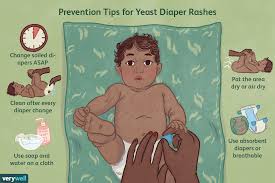 Typically with viruses, the higher the viral load. Yeast Diaper Rash Signs And Treatment