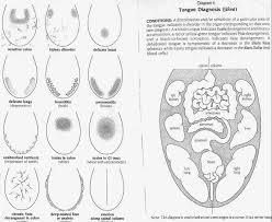 ayurvedic tongue diagnosis analyse de la langue selon l