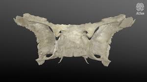 Image result for Sphenoid Bone