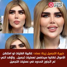 خبيرة التجميل زينة عماد: غالبية الفتيات لو امتلكن الأموال لكانوا سيخضعن  لعمليات تجميل.. وأؤكد أنني لم أتجاوز الحدود في عمليات التجميل التعليق لكم  #الحدث_اليوم 👇👇